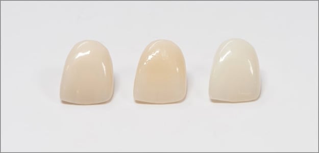 Zirconia Crowns Preparation Guidelines Ddslab